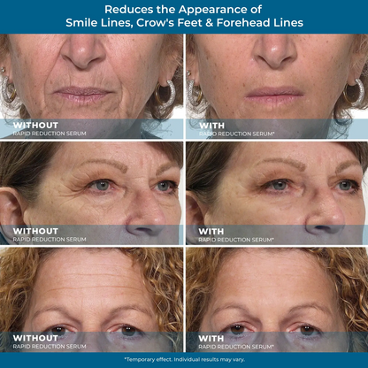 Rapid Reduction Serum